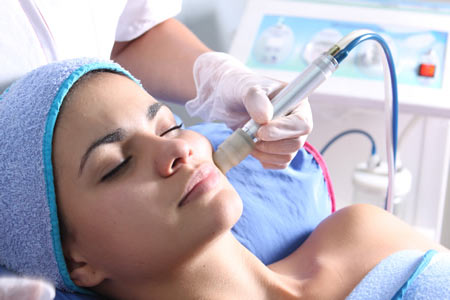 Microdermoabrasión para acné