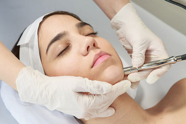 Microdermoabrasión para cicatrices