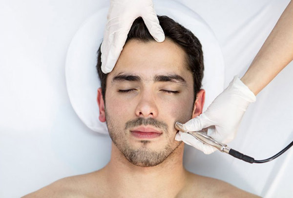 Microdermoabrasión para manchas